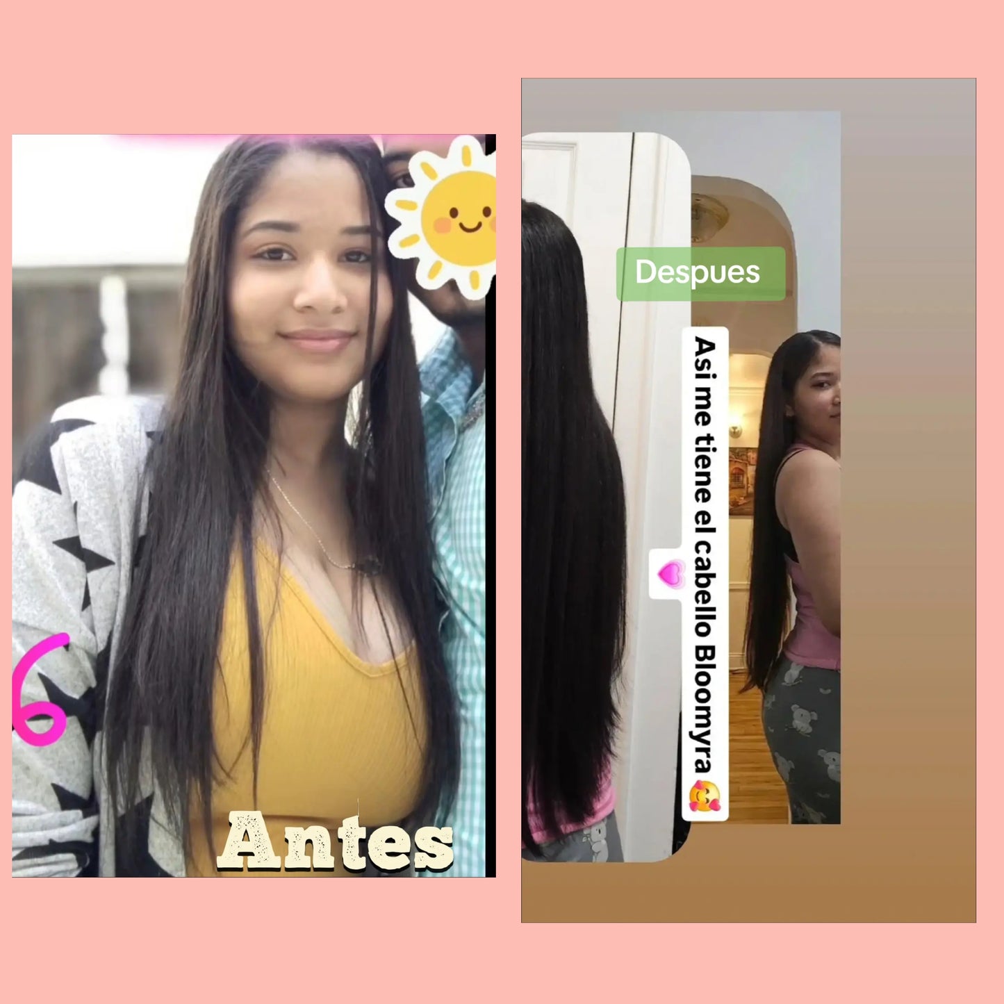 Hair growth kit  Bloomyra